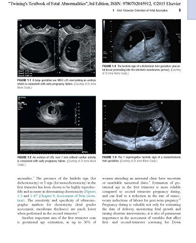 Twining's Textbook of Fetal Abnormalities: Expert Consult: Online and Print