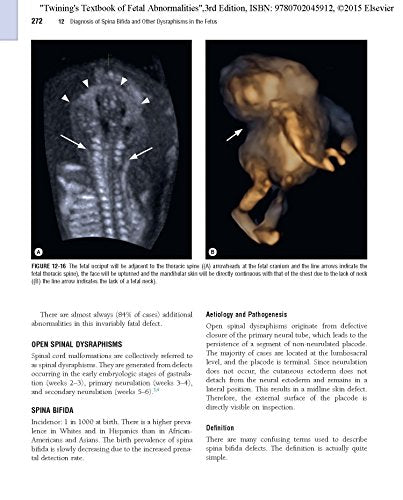 Twining's Textbook of Fetal Abnormalities: Expert Consult: Online and Print