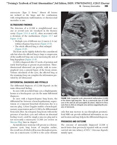 Twining's Textbook of Fetal Abnormalities: Expert Consult: Online and Print